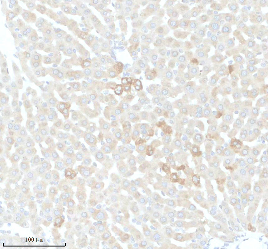 IHC analysis of KLB using anti-KLB antibody (A05877-1)
