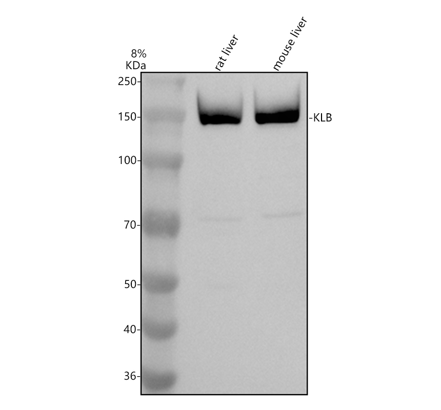 Western blot analysis of KLB using anti-KLB antibody (A05877-1)