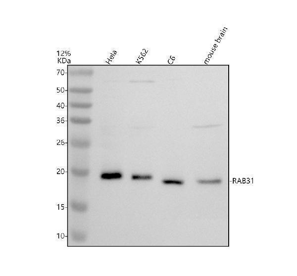 a05883 2 rab31 primary antibodies wb testing 1