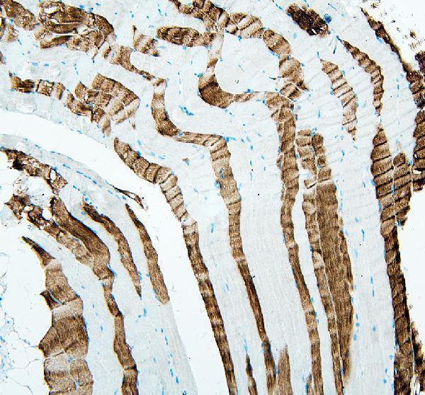 a05885 2 tnnt3 primary antibodies ihc testing 1