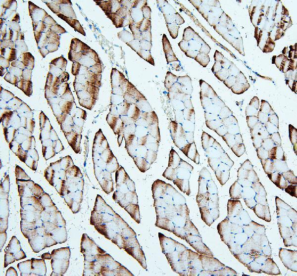 a05885 2 tnnt3 primary antibodies ihc testing 2