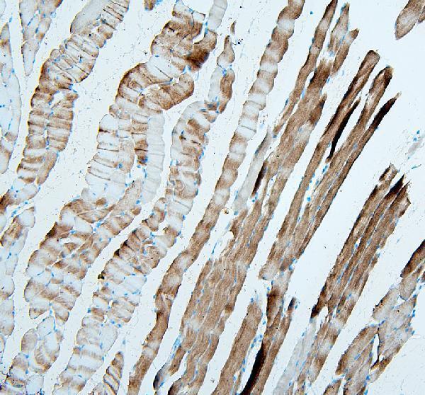 a05885 2 tnnt3 primary antibodies ihc testing 3