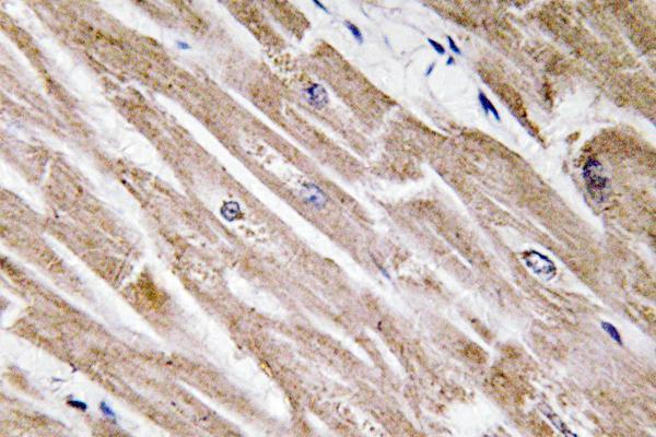 Immunohistochemistry analysis of BMP-5 antibody in paraffin-embedded human heart tissue
