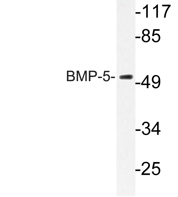 Western blot analysis of lysate from HUVEC cells, using BMP-5 antibody