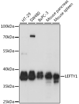 a05889 1 lefty1 primary antiboties wb testing 1