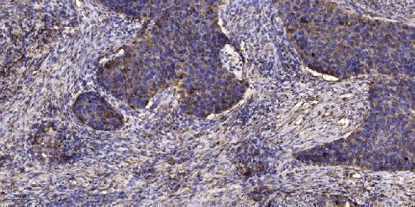 a05889 lefty1 primary antibodies ihc testing 1