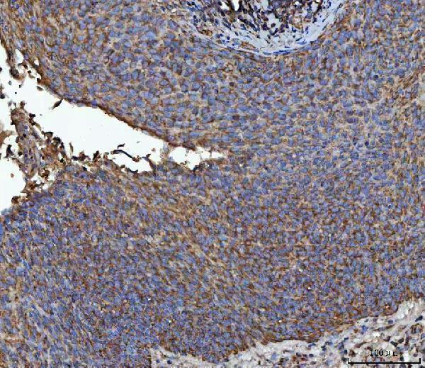  IHC analysis of NIT2 using anti-NIT2 antibody (A05891-3)