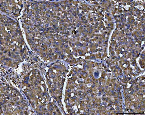  IHC analysis of NIT2 using anti-NIT2 antibody (A05891-3)