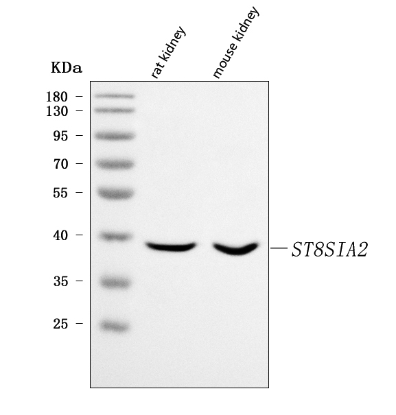  Western blot analysis of ST8SIA2 using anti-ST8SIA2 antibody (A05894-1)