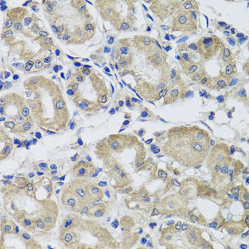 Immunohistochemistry of paraffin-embedded human gastric using ST8SIA2 antibody at dilution of 1:100 (x40 lens)