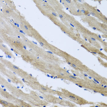 Immunohistochemistry of paraffin-embedded rat heart using ST8SIA2 antibody at dilution of 1:100 (x40 lens)