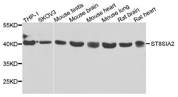 Western blot analysis of extracts of various cells, using ST8SIA2 antibody