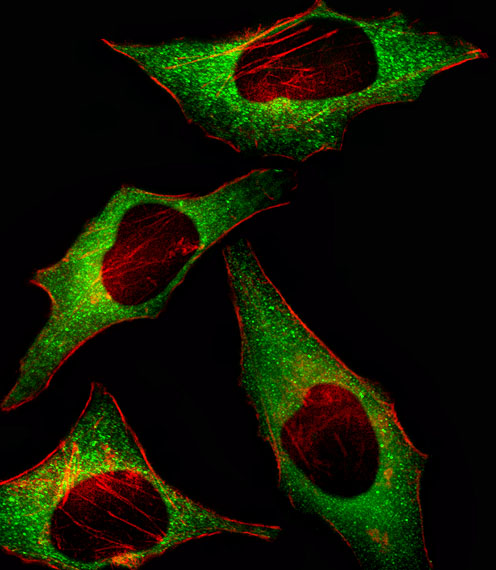 a05895 1 anti hip2 antibody center if testing 1