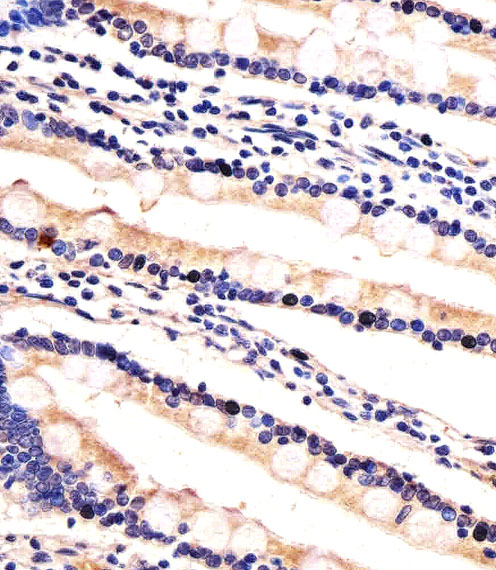 a05895 1 anti hip2 antibody center ihc p testing 3