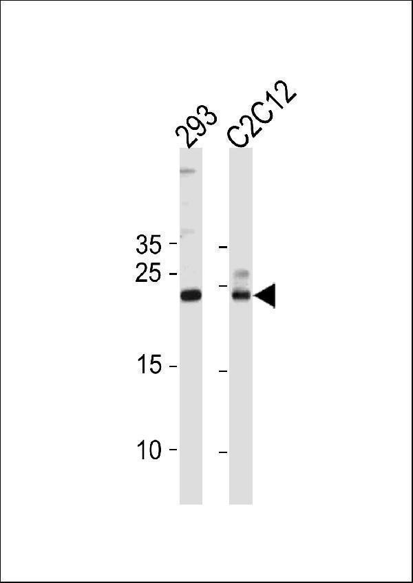 a05895 1 anti hip2 antibody center wb testing 2