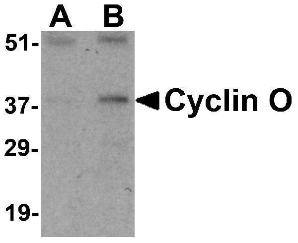 Western blot analysis of Cyclin O in mouse bladder tissue lysate with Cyclin O antibody at (A) 1 and (B) 2 μg/mL