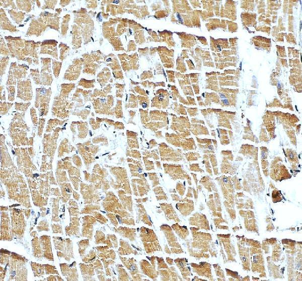 a05901 2 ankrd2 primary antibodies ihc testing 1