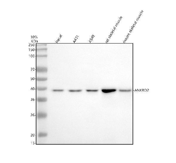 a05901 2 ankrd2 primary antibodies wb testing 1