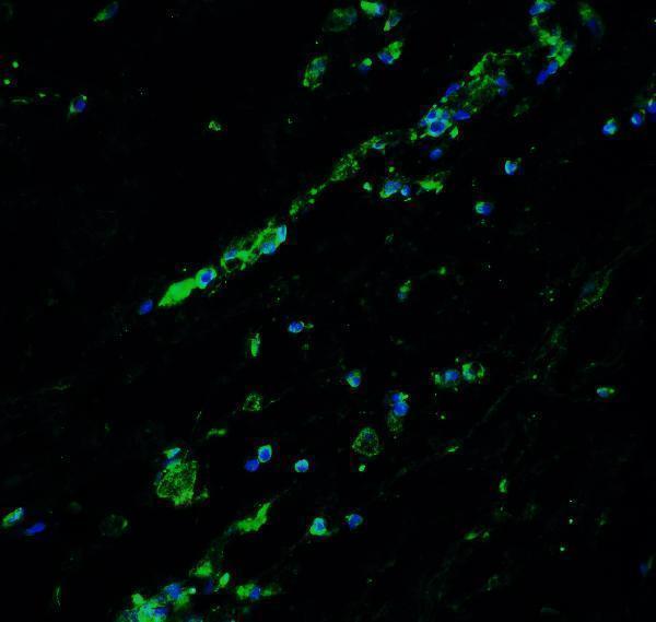 Immunofluorescence of Bcl9L in human breast tissue with Bcl9L antibody at 20 μg/ml