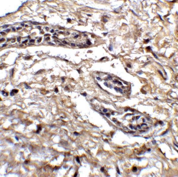 a05905 1 bcl9l primary antibodies ihc testing 4