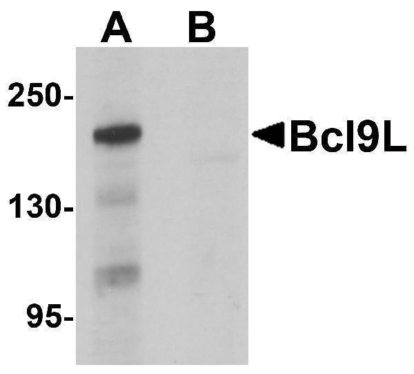 Western blot analysis of Bcl9L in HeLa cell lysate with Bcl9L antibody at 1 μg/mL in (A) the absence and (B) the presence of blocking peptide