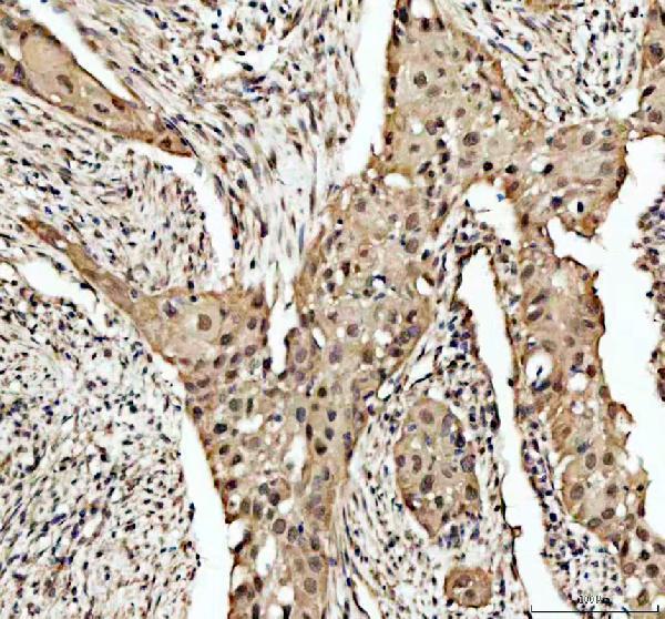 a05905 bcl9l primary antibodies ihc testing 1