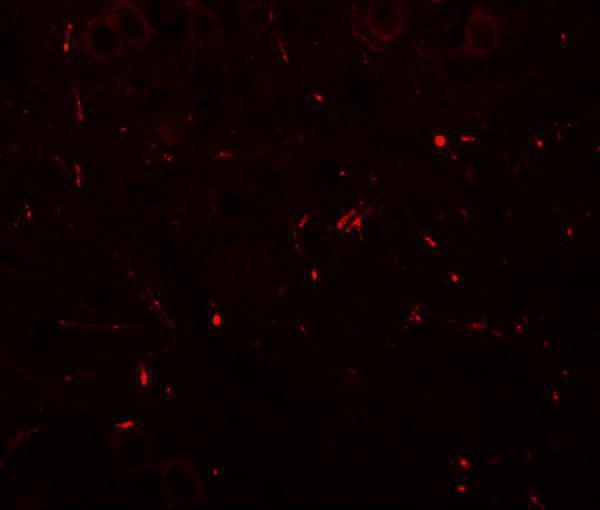 Immunofluorescence of SEC62 in mouse brain tissue with SEC62 antibody at 20 μg/mL