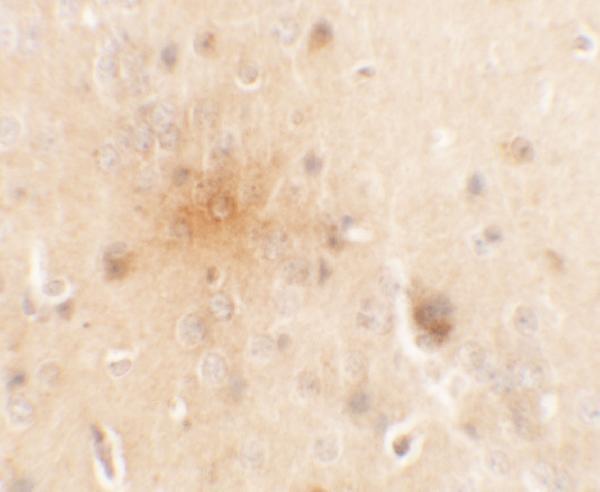 Immunohistochemistry of SEC62 in mouse brain tissue with SEC62 antibody at 5 μg/mL