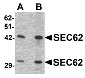 Western blot analysis of SEC62 in rat brain tissue lysate with SEC62 antibody at (A) 0