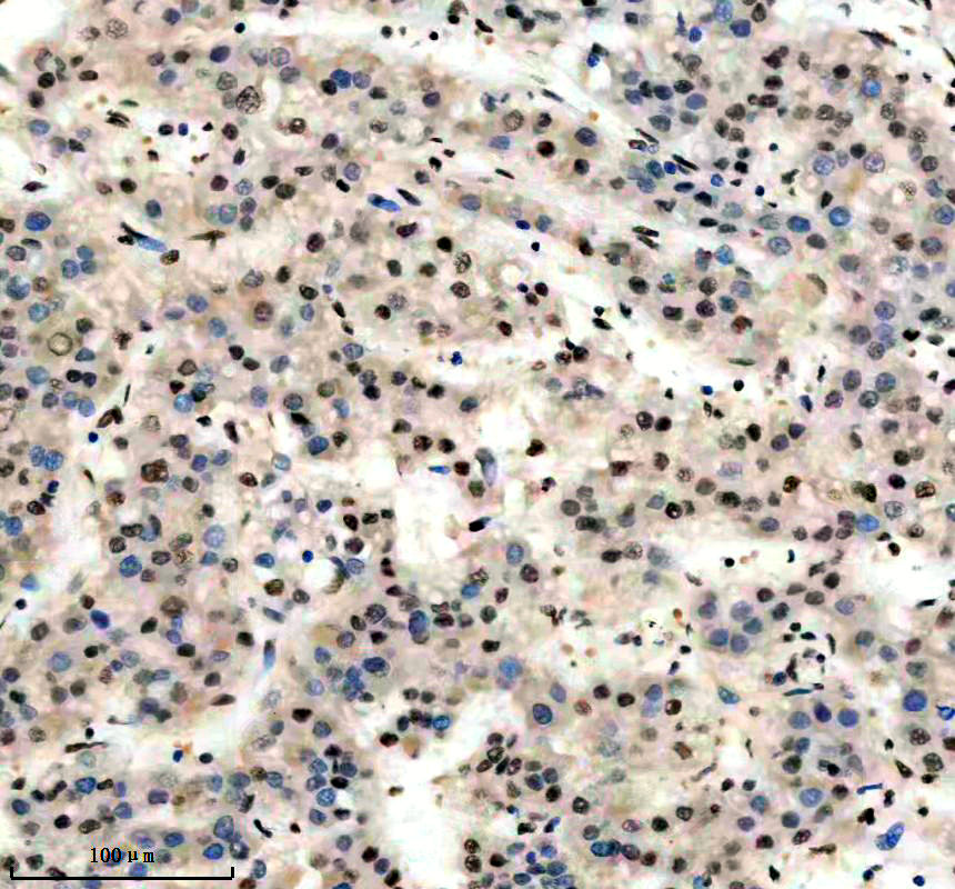 IHC analysis of HNRNPUL1 using anti-HNRNPUL1 antibody (A05907-1)