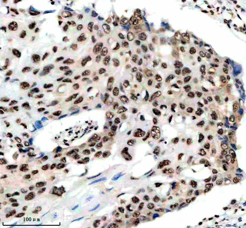 IHC analysis of HNRNPUL1 using anti-HNRNPUL1 antibody (A05907-1)