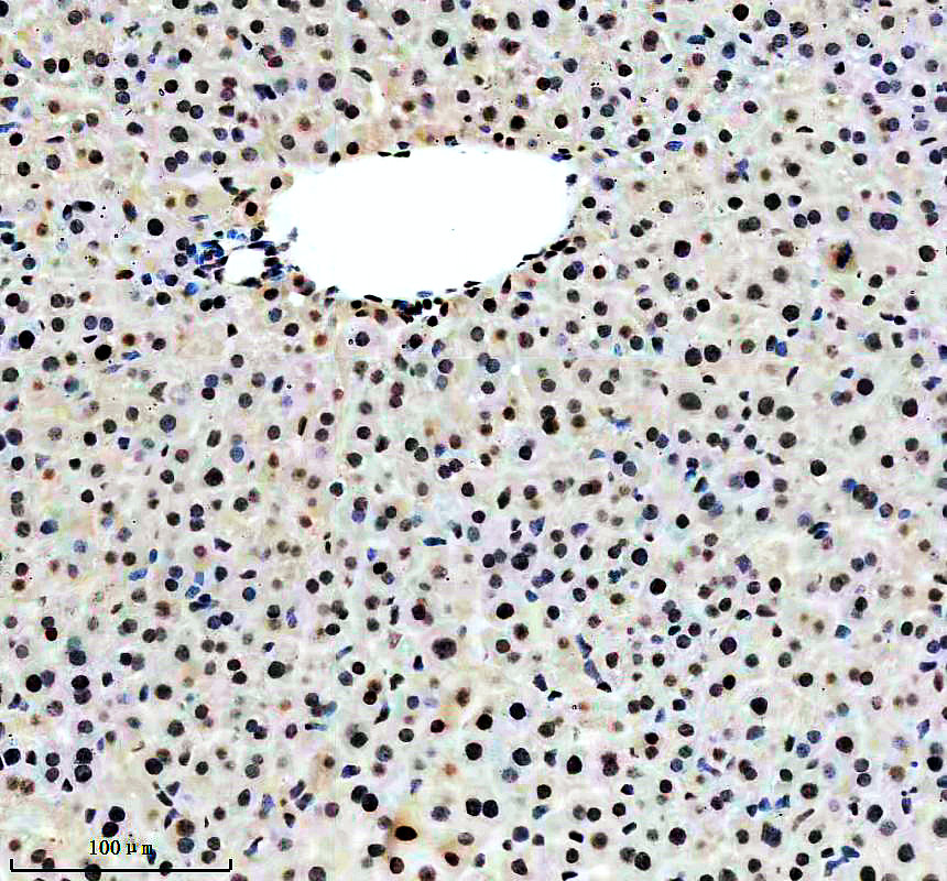a05907 1 hnrnpul1 primary antibodies ihc testing 3