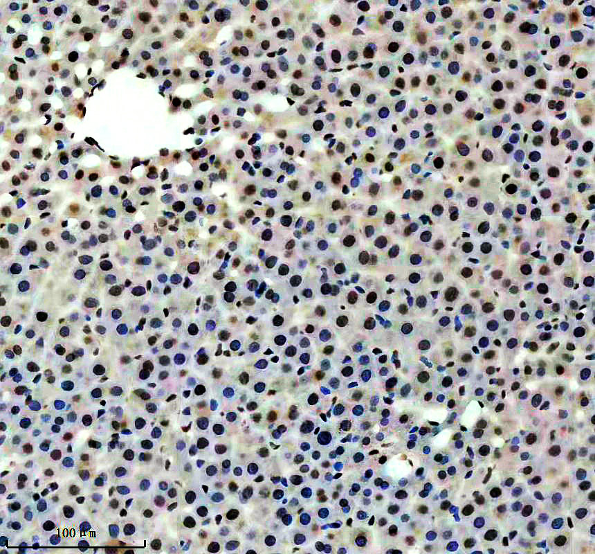 a05907 1 hnrnpul1 primary antibodies ihc testing 4