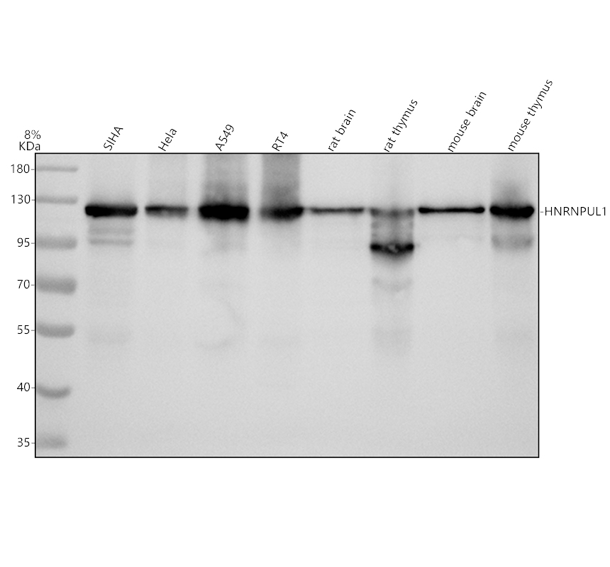 Western blot analysis of HNRNPUL1 using anti-HNRNPUL1 antibody (A05907-1)