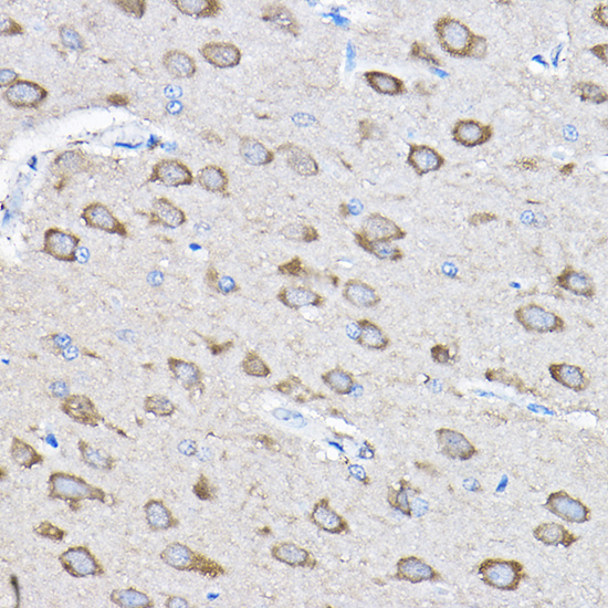 a05909 ptpn23 primary antiboties ihc testing 2