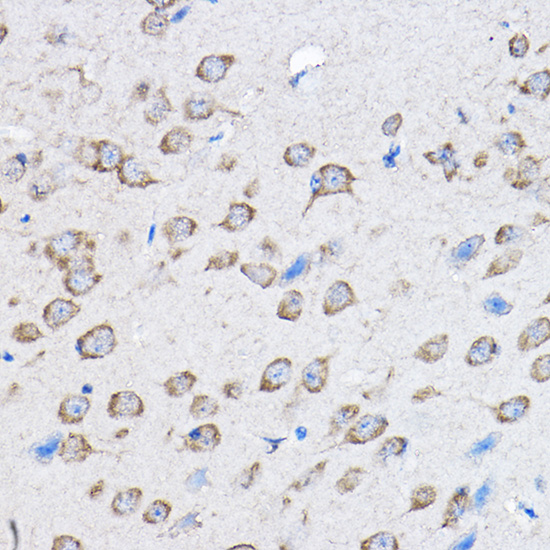 a05909 ptpn23 primary antiboties ihc testing 3