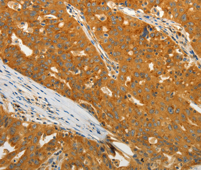 a05911 uso1 primary antiboties ihc testing 2