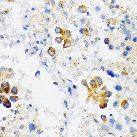a05911 uso1 primary antiboties ihc testing 3