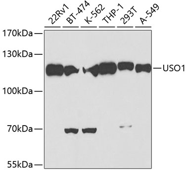 a05911 uso1 primary antiboties wb testing 1
