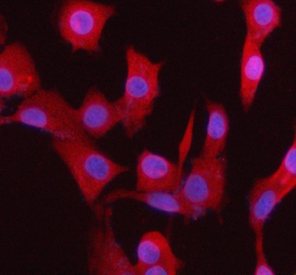 a05912 2 bccip primary antibodies if testing 8