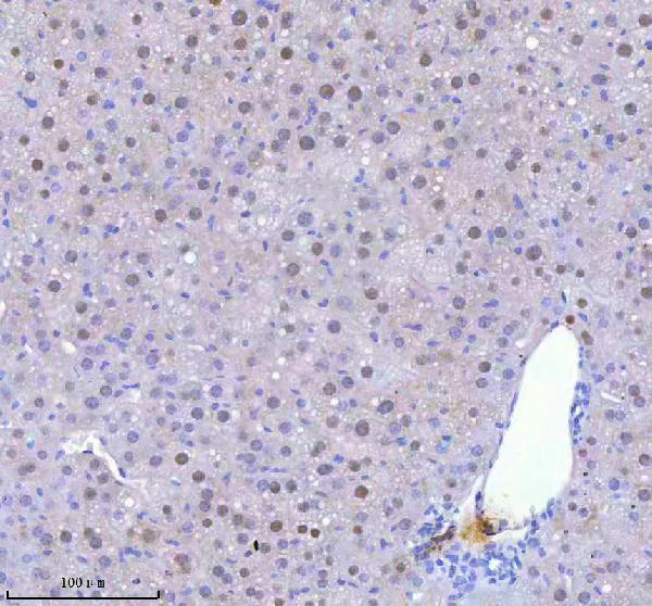 a05912 2 bccip primary antibodies ihc testing 3