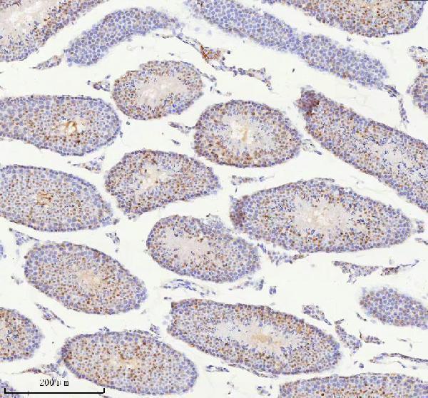 a05912 2 bccip primary antibodies ihc testing 4