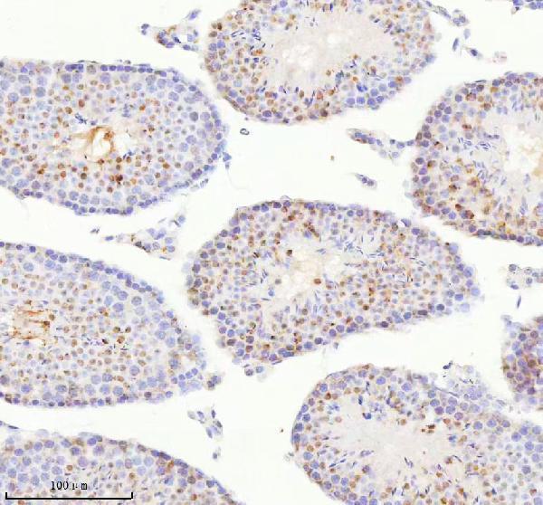 a05912 2 bccip primary antibodies ihc testing 5