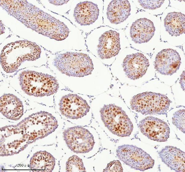 a05912 2 bccip primary antibodies ihc testing 6