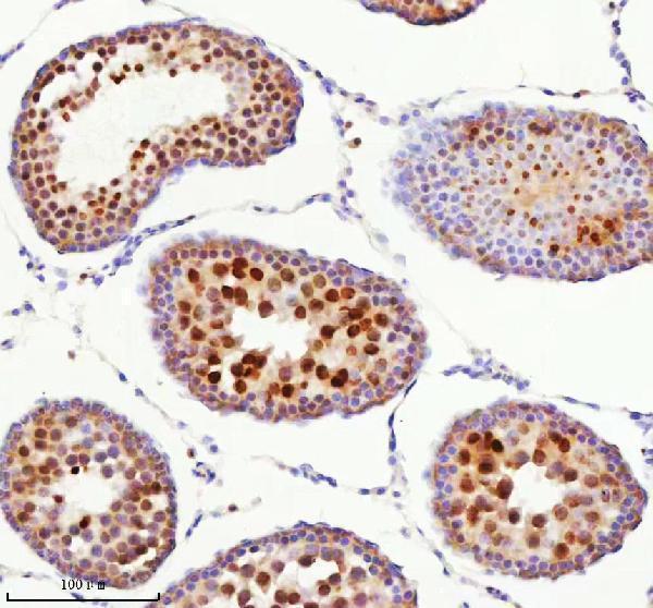 a05912 2 bccip primary antibodies ihc testing 7