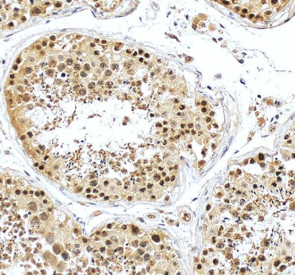 a05912 2 bccip primary antibodies ihc testing 8