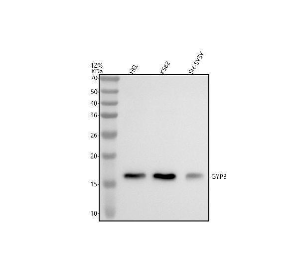 a05915 1 gypb primary antibodies wb testing 1