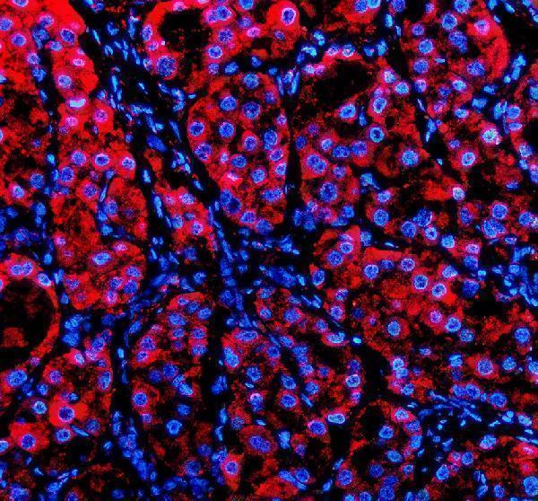 a05917 2 p4ha1 primary antibodies if testing 1