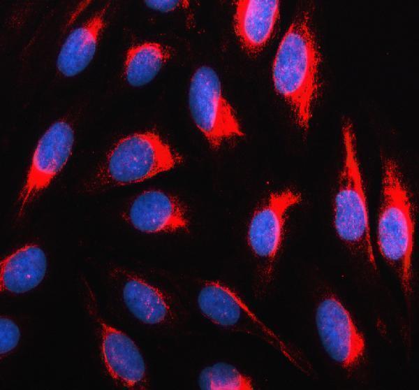 a05917 2 p4ha1 primary antibodies if testing 2