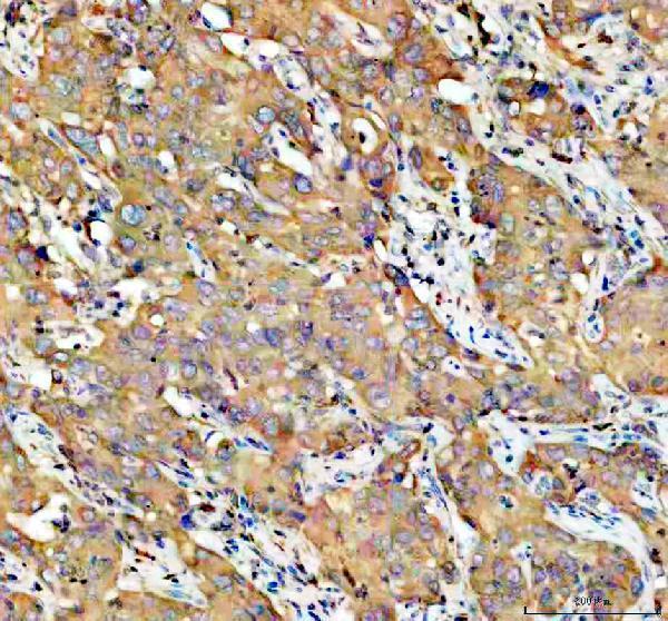 IHC analysis of P4HA1 using anti-P4HA1 antibody (A05917-2)